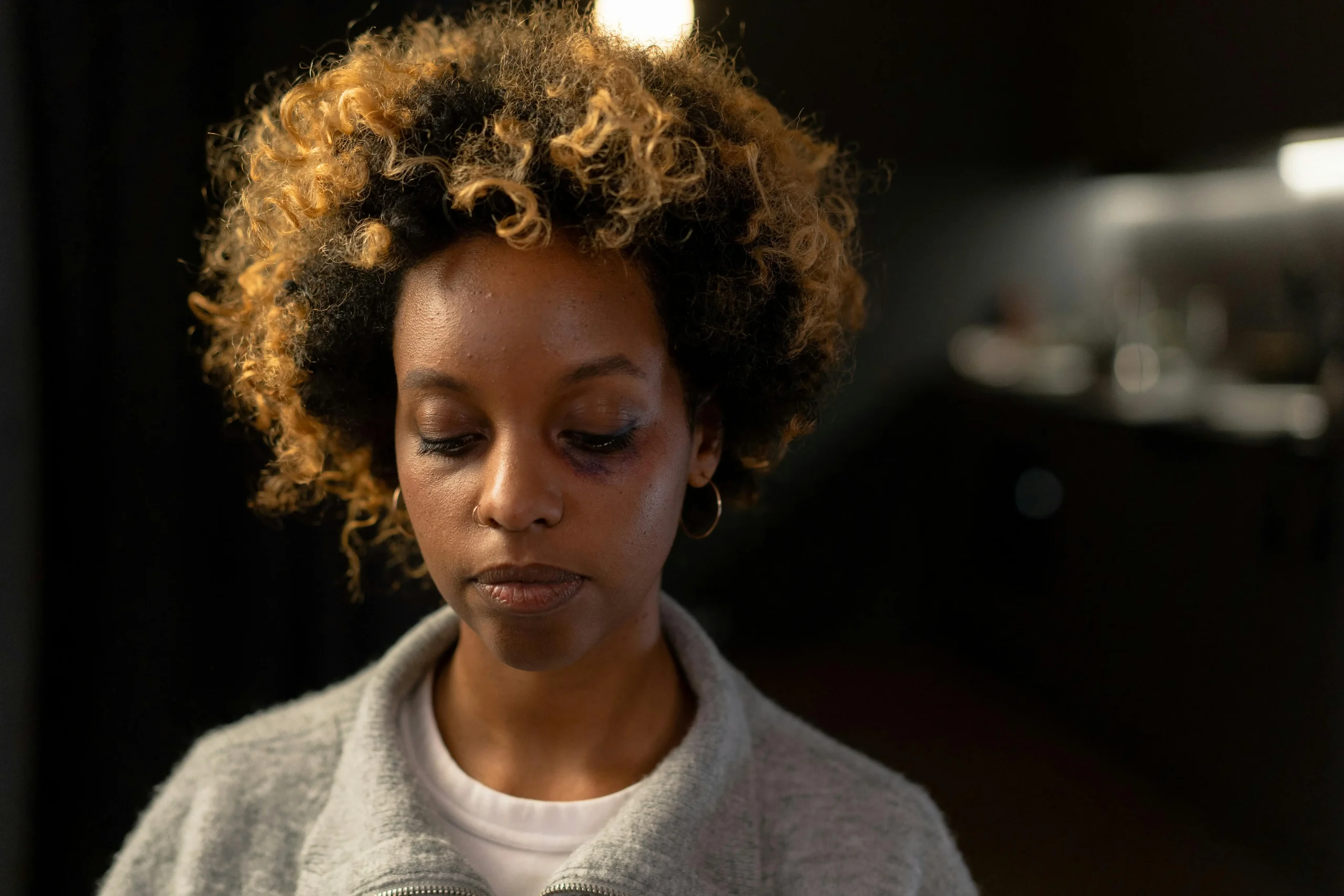 Woman with black eye illustrating trauma exposure and PTSD symptoms treated by Calgary psychologist